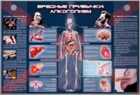 Электрифицированный стенд "Вредные привычки: алкоголизм" - «globural.ru» - Новый Уренгой