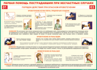 Таблица Порядок действий при опасном кровотечении 1000*1400 винил - «globural.ru» - Новый Уренгой