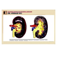 Рельефная таблица "Почка. Фронтальный разрез" (формат А1, матовое ламинир.) - «globural.ru» - Новый Уренгой