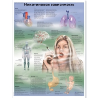 Плакат "Никотиновая зависимость", ламинированный, 50*67 см - «globural.ru» - Новый Уренгой